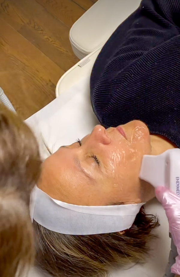 Radiofrequenz-Gesichtsbehandlung, IG @sadaf_jaffari | Treatwell