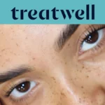 Türkisfarbenes Treatwell-Banner mit Nahaufnahme natürlich gelifteter Wimpern nach einem koreanischen Wimpernlift auf sommersprossiger Haut
