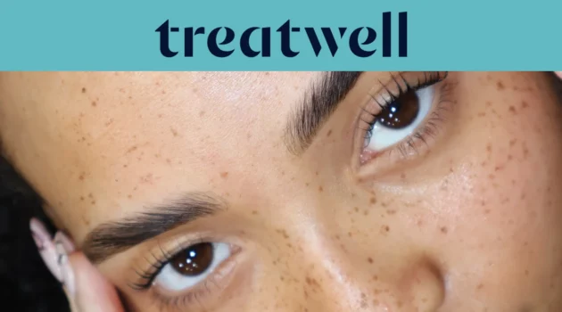 Türkisfarbenes Treatwell-Banner mit Nahaufnahme natürlich gelifteter Wimpern nach einem koreanischen Wimpernlift auf sommersprossiger Haut